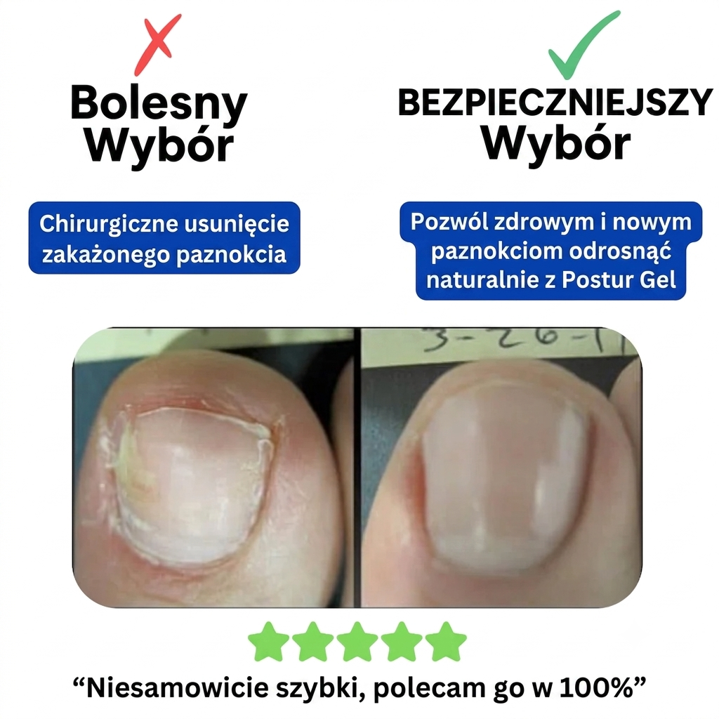 Plastry Hemios do zwalczania grzybicy, zwalczania paznokci oraz do korekcji wrastających paznokci