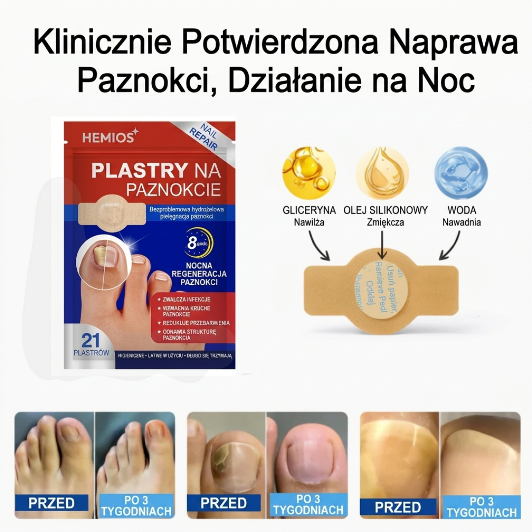 Plastry Hemios do zwalczania grzybicy, zwalczania paznokci oraz do korekcji wrastających paznokci